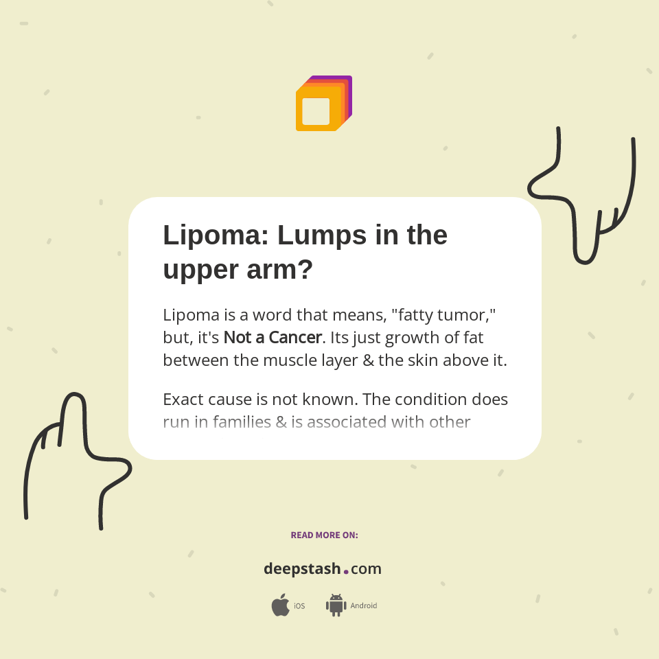 Lipoma Lumps in the upper arm? Deepstash